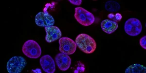 Καρκίνος: Θεραπεία με βλαστοκύτταρα ανοίγει τον δρόμο για οριστική ίαση